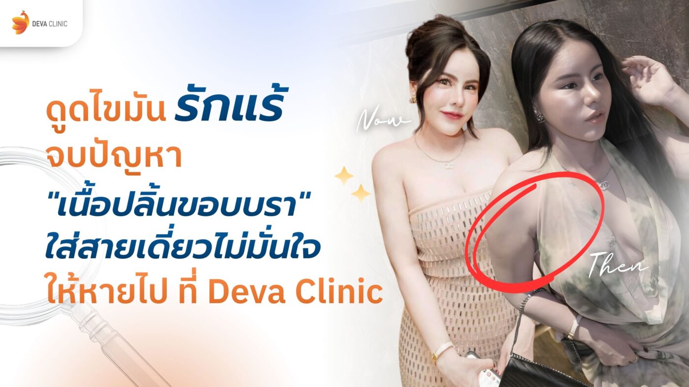 ดูดไขมันรักแร้