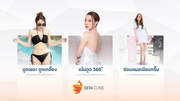 หมดปัญหาแขนย้วย หลังดูดไขมัน มั่นใจในผลลัพธ์และความปลอดภัยที่ DEVA CLINIC 03