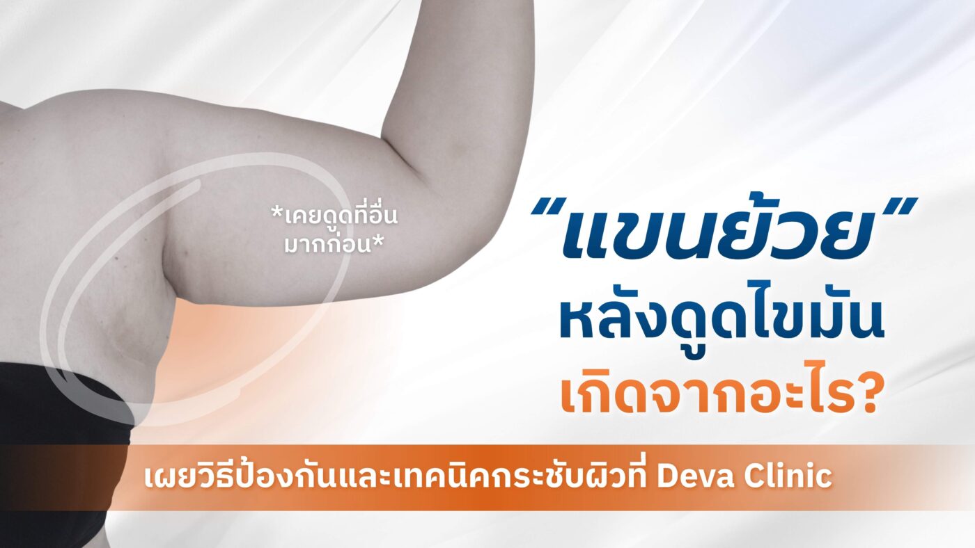 แขนย้วย หลังดูดไขมัน