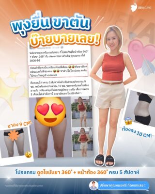 รีวิวแชทดูดไขมันต้นขา คุณกล้วยไม้