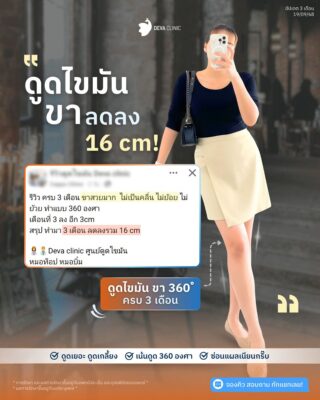 รีวิวความประทับใจ หลังดูดไขมันขา 360 องศา คุณมนต์