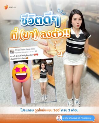 รีวิวความประทับใจ หลังดูดไขมันขา 360 องศา คุณน้อง 2