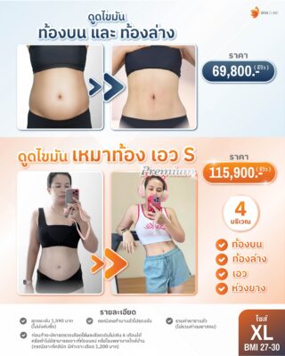 ราคาดูดไขมันหน้าท้อง XL
