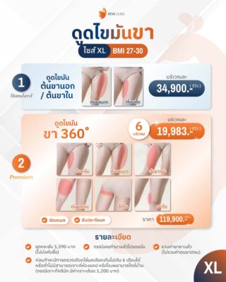 ราคาดูดไขมันต้นขา XL