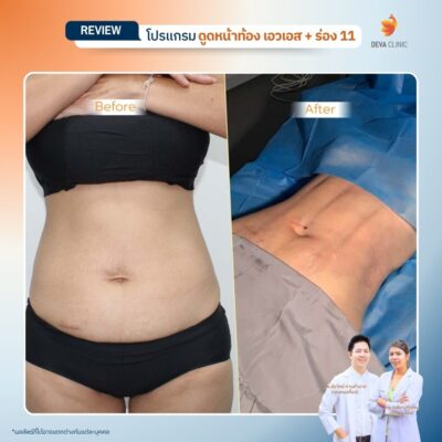 รีวิว sexy line 12