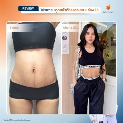 รีวิว sexy line 4