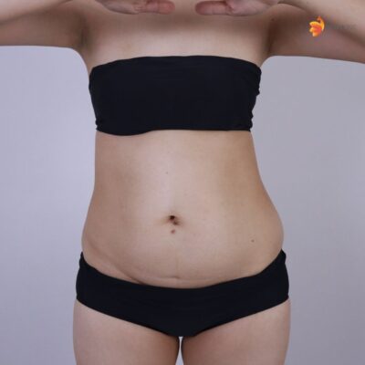 ก่อนทำ คุณกล้วยไม้ 2