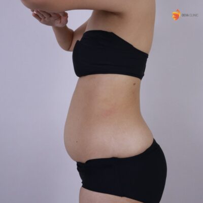 ก่อนทำ คุณกล้วยไม้ 3