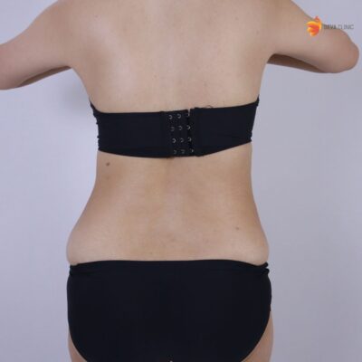 ก่อนทำ คุณกล้วยไม้ 4