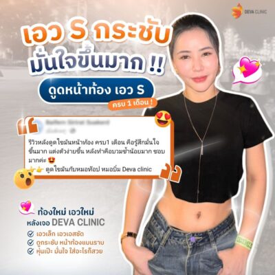 รีวิวเคสเปลี่ยนหุ่นหนาเป็นเอวบางที่ Deva Clinic 2