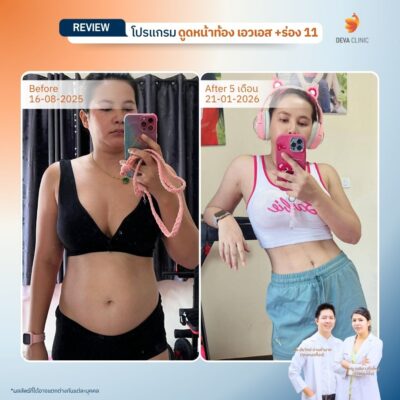 รีวิว sexy line 1