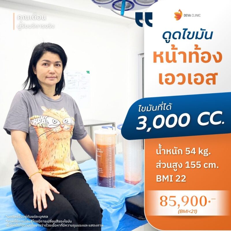 รูปไขมัน คุณเดือน