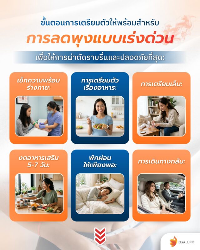 ขั้นตอนการเตรียมตัวให้พร้อมสำหรับการลดพุงแบบเร่งด่วน