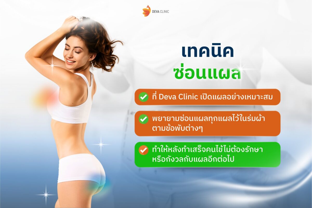 เทคนิค “ซ่อนแผล” : หัวใจสำคัญของหน้าท้องที่สวยสมบูรณ์