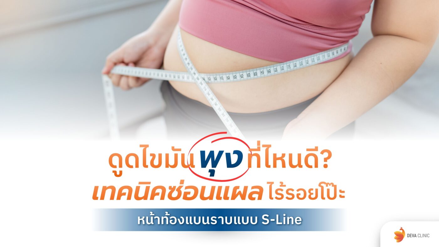 ดูดไขมันพุง