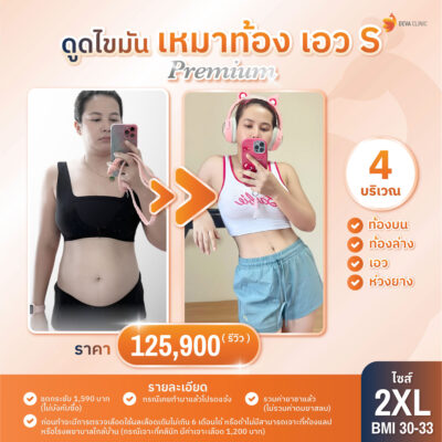 ราคาดูดไขมันหน้าท้อง เอว ห่วงยาง size 2XL