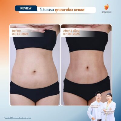 รีวิวก่อนหลังปั้นหุ่น S Curve 14