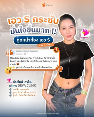 รีวิวก่อนหลัง ดูดไขมันหน้าท้อง 4