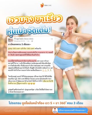 รีวิวก่อนหลัง ดูดไขมันหน้าท้อง 3