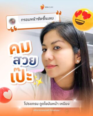 รีวิวภาพก่อน-หลัง ลดเหนียง 3