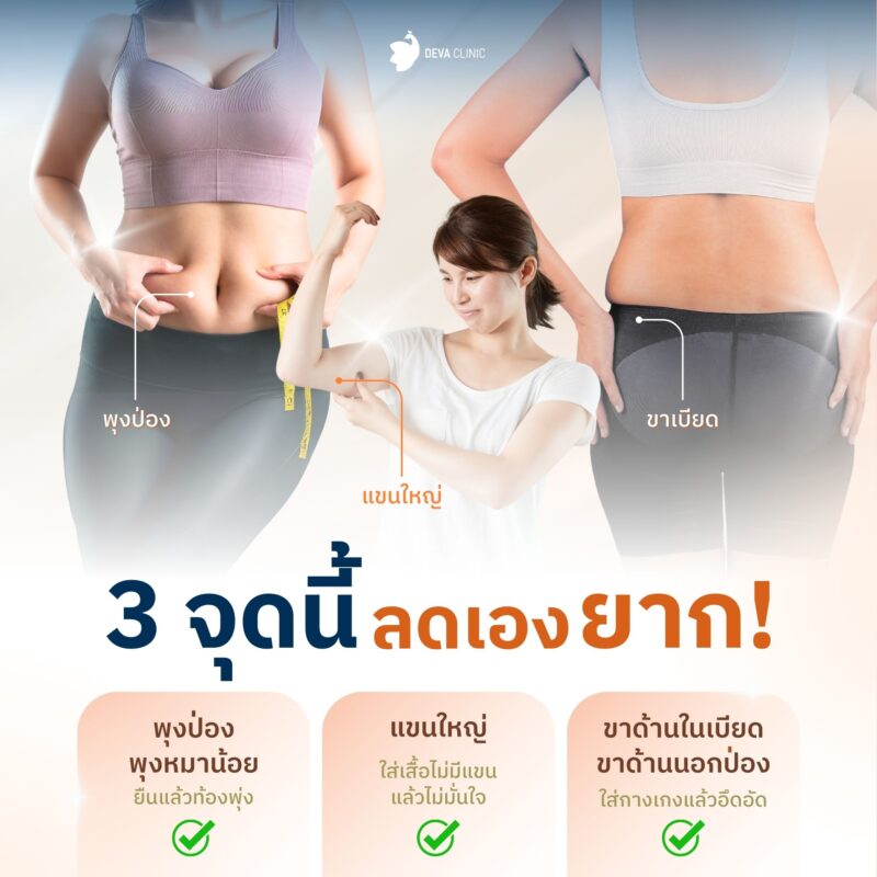 3 จุดยอดนิยมดูดไขมัน แขน ขา หน้าท้อง: เคล็ดลับหุ่นเป๊ะปังแบบไม่ต้องพยายามหนัก