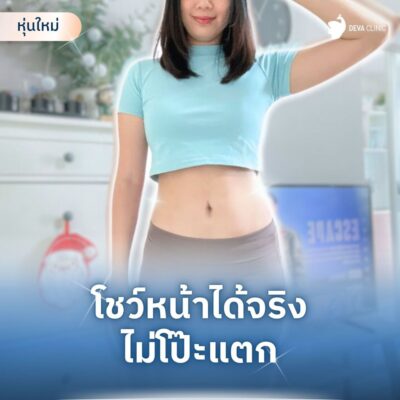 รีวิว “เทคนิคซ่อนแผลเนียน” ดูดไขมันหน้าท้อง แผลอยู่ตรงไหน 3