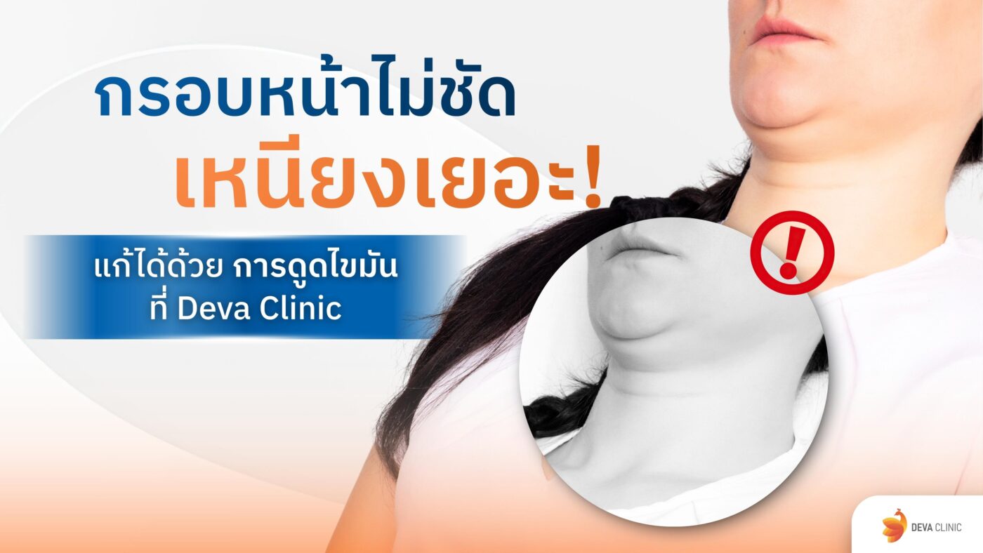 กรอบหน้าไม่ชัด