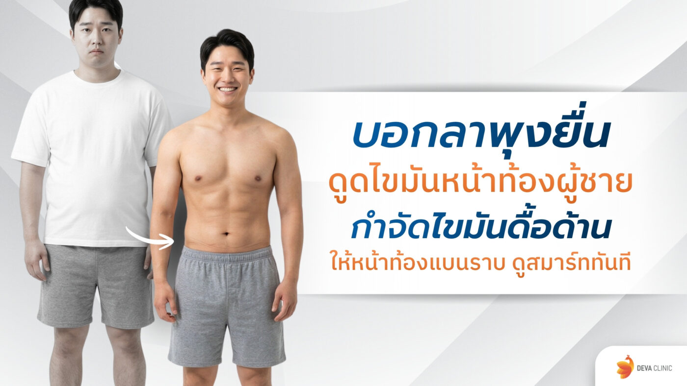 ดูดไขมันหน้าท้องผู้ชาย