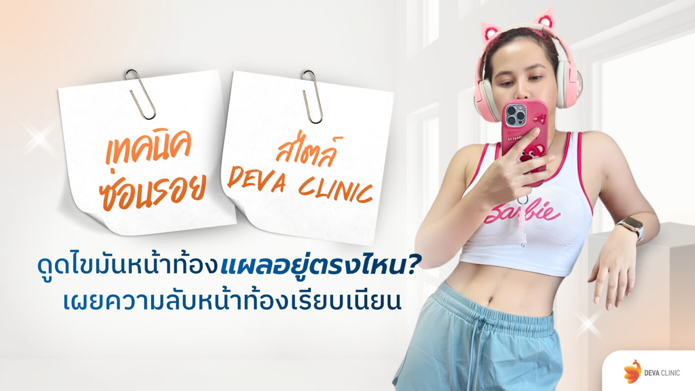 ดูดไขมันหน้าท้อง แผลอยู่ตรงไหน