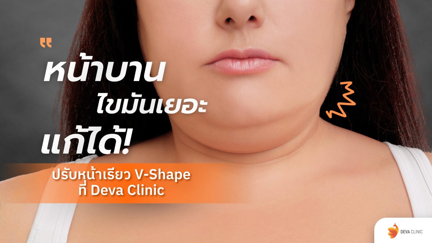 หน้าบาน