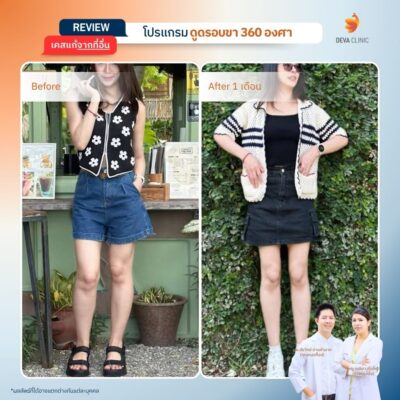 รีวิวเคสแก้ ที่จ่ายแพงกว่าทำครั้งแรก 25