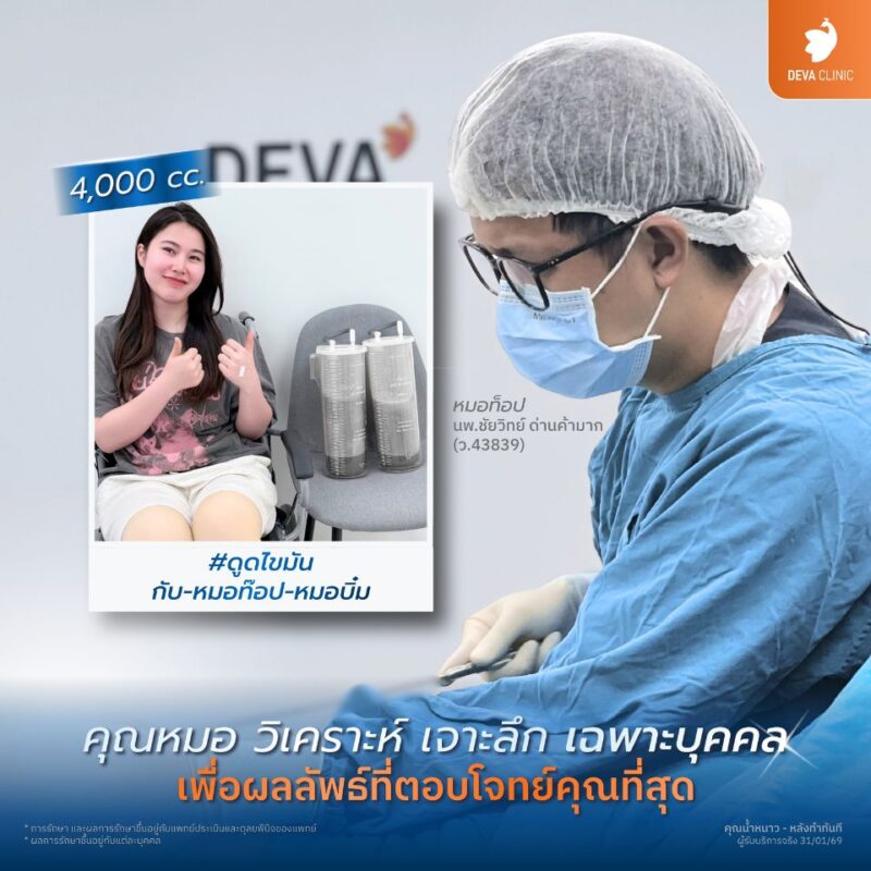 ดูดไขมันต้นขา ทีมแพทย์ประสบการณ์สูงด้านการปรับรูปร่าง