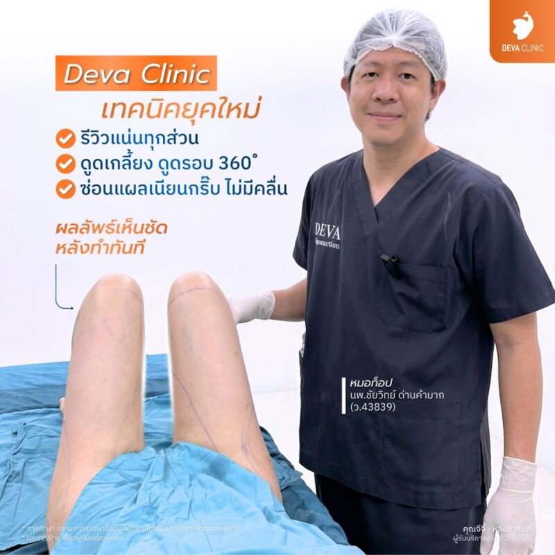 ดูดไขมันต้นขา เทคนิคดูดไขมันต้นขา 360°
