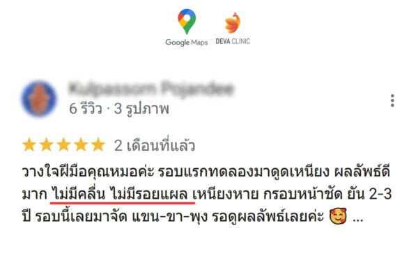 รีวิวแผลดูดเหนียง ไม่เจ็บ แผลเล็ก 2