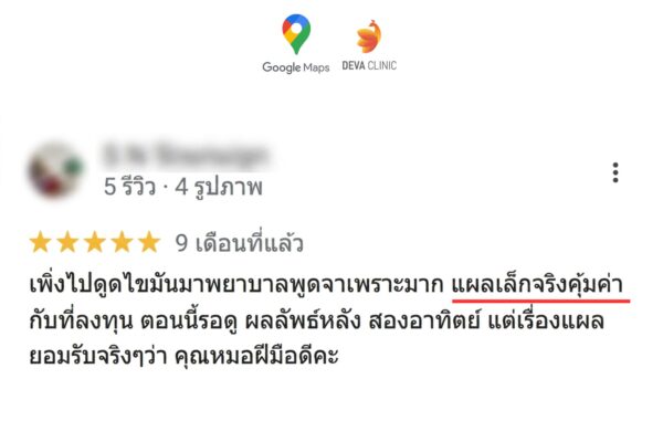 รีวิวแผลดูดเหนียง ไม่เจ็บ แผลเล็ก 4