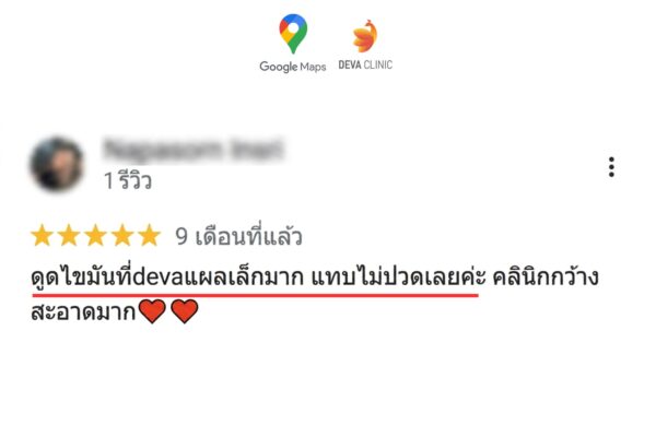รีวิวแผลดูดเหนียง ไม่เจ็บ แผลเล็ก 5