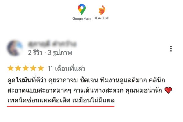 รีวิวแผลดูดเหนียง ไม่เจ็บ แผลเล็ก 6
