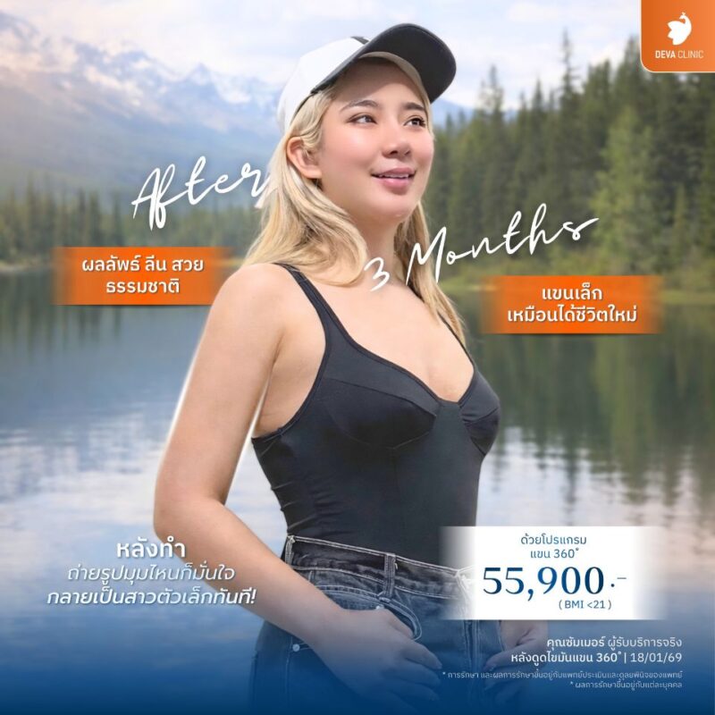 4 ผลลัพธ์และสิ่งที่จะได้รับเมื่อตัดสินใจดูดไขมันต้นแขน แขนดูลีนสวย มีเคิร์ฟกล้ามเนื้อธรรมชาติ