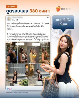 รีวิวดูดไขมันต้นแขน 360 องศา รีวิวแชท 03