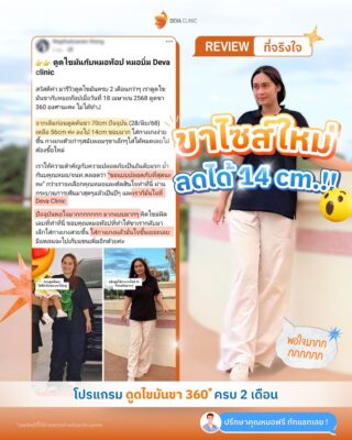 รีวิวดูดไขมันต้นขา 360 องศา รีวิวแชท 03