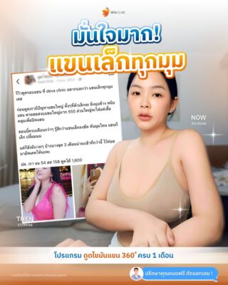 รีวิวดูดไขมันต้นแขน 360 องศา รีวิวแชท 07