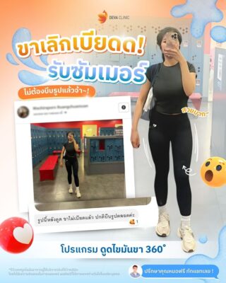 รีวิวดูดไขมันต้นขา 360 องศา รีวิวแชท 06