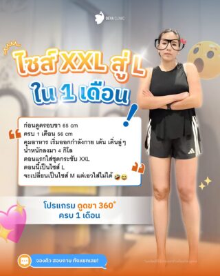 รีวิวดูดไขมันต้นขา 360 องศา รีวิวแชท 04