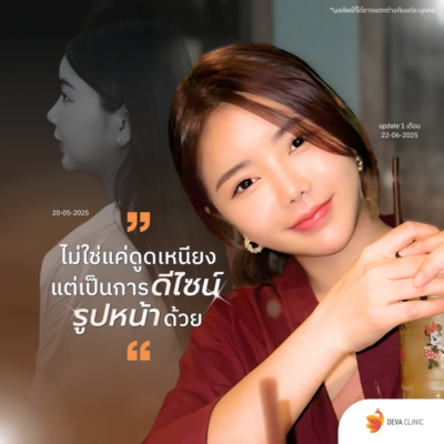 รีวิวดูดไขมันหน้า เหนียง ดีว่าคลินิก ดีไหม 01