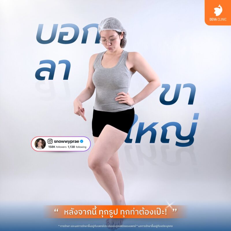 3. ดูดขา 360 องศา (Thigh Liposuction 360°) - ดีว่าคลินิก pantip 01