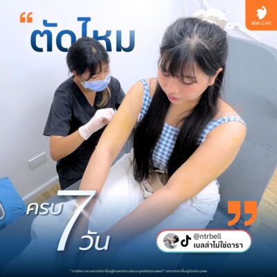 รายการของแถมและบริการดูแลหลังทำ (Aftercare) ที่รวมอยู่ในราคาแล้ว 02