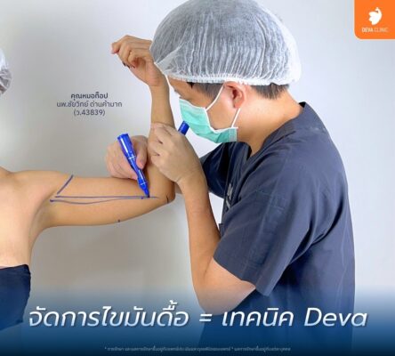 Deva Clinic ดีไหม ประสบการณ์จากผู้ใช้จริง: เปลี่ยนจากไซส์ XL เป็น S 02