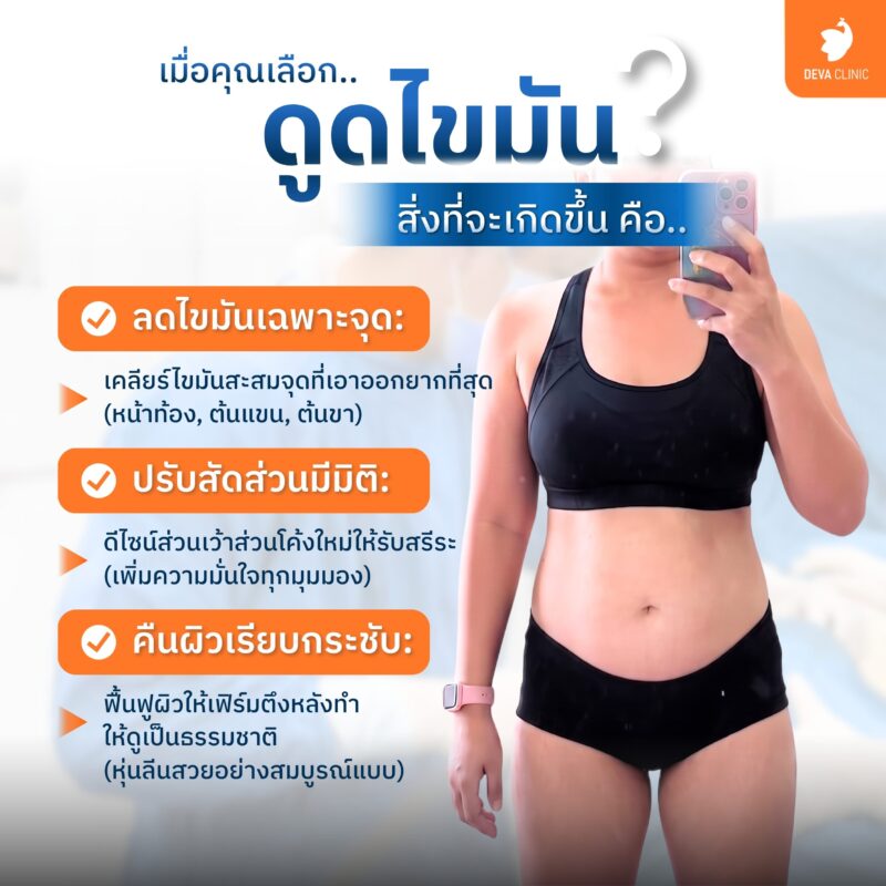 ดูดไขมัน (Liposuction) คืออะไร - ดูดไขมัน รัชดา