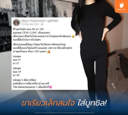 รีวิวดูดไขมันต้นขา 360 องศา ดีว่าคลินิก ดีไหม 03