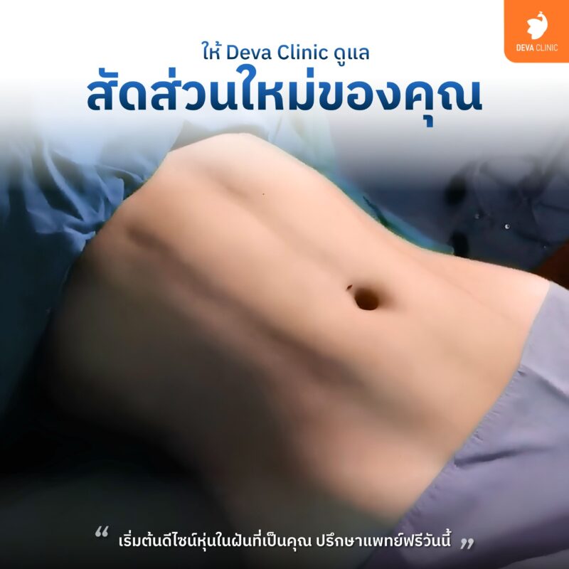 หน้าท้องและเอวเอส - ดูดไขมัน นาคนิวาส